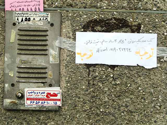 Iran Kidney: Iran Kidney7