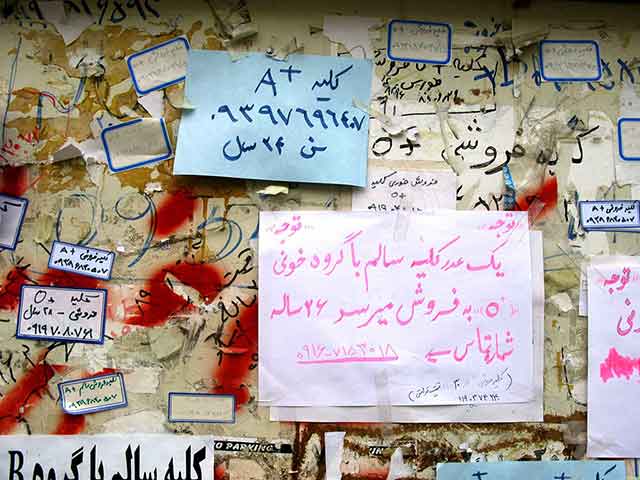 Iran Kidney: Iran Kidney8