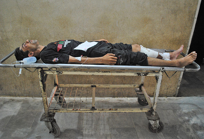 24 hours: An injured pakistan policeman caught by a roadside bomb