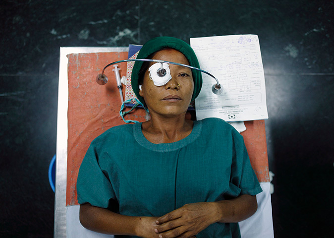24 hours: Katmandu, Nepal: A patient with a cataract lies on a hospital bed