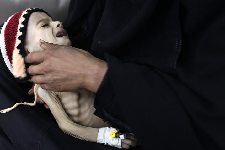 Picture Desk Live: Woman holds her malnourished child in Yemen