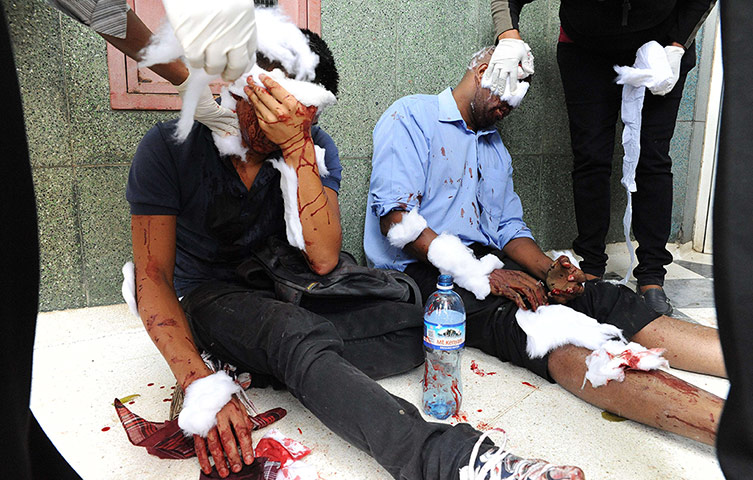 Picture Desk Live: Victims of a blast in central Nairobi