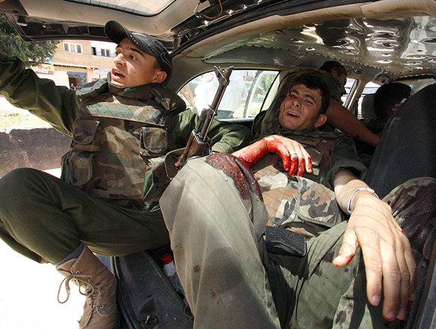 Picture desk live: A Syrian soldier injured in an explosion is taken to hospital