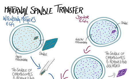 Diagram illustrating maternal spindle transfer