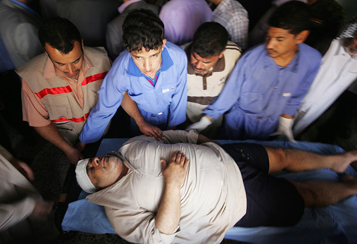 Picture desk live: A man wounded in a bomb attack is treated at a hospital in Kerbala