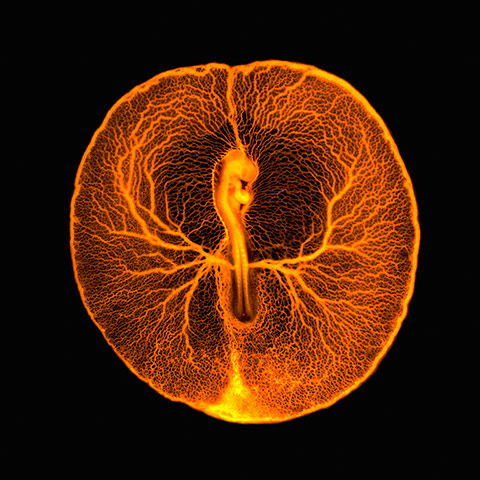 Wellcome: B0008295 Chicken embryo vascular system