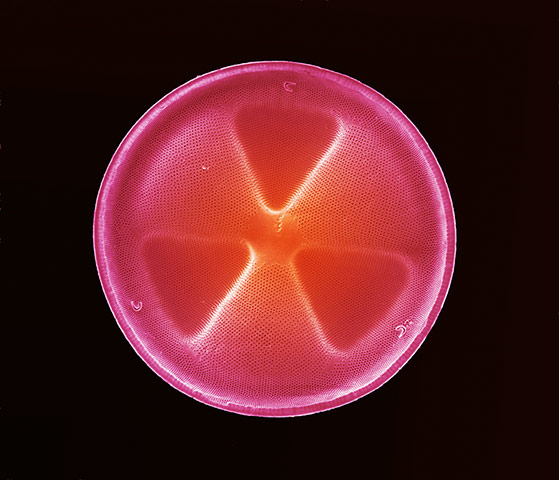 Wellcome: Diatom frustule