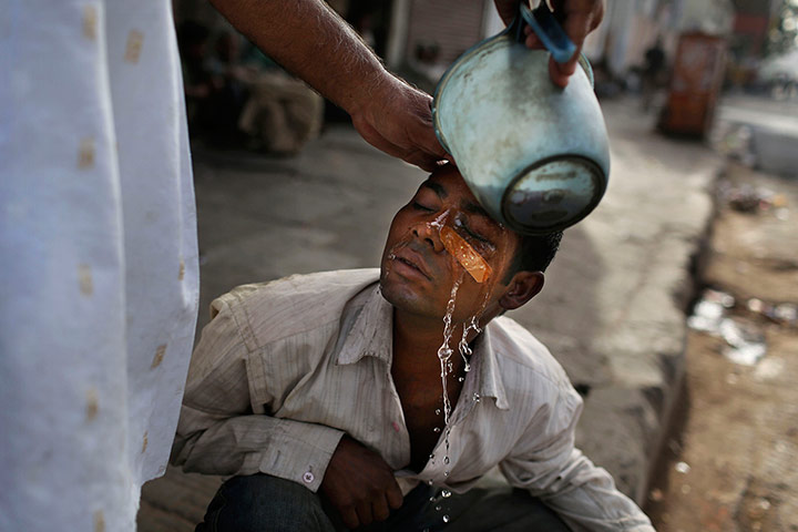 24 Hours: A homeless Indian man has his injured eye washed out at a street clinic