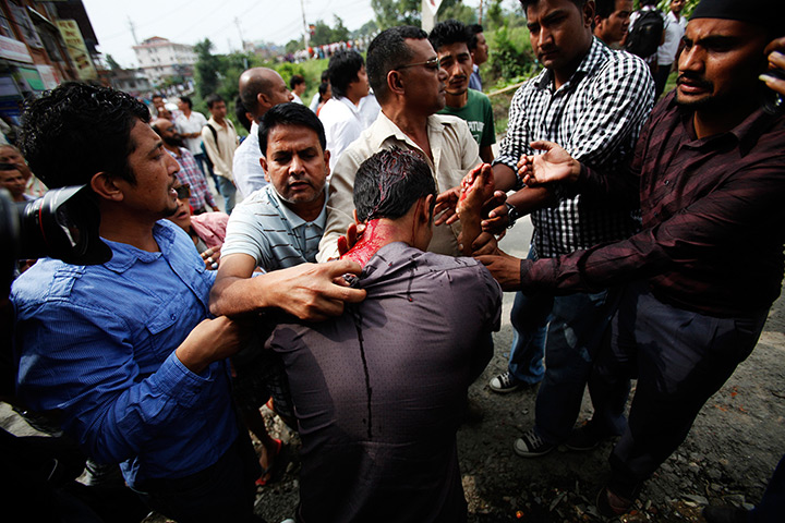 24 hours in pictures: A Nepalese anti-government protester shows his wound