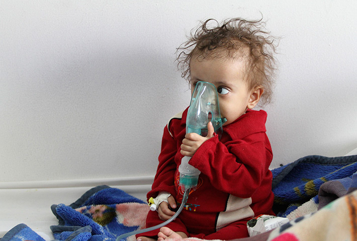 24 hours: Sana'a, Yemen: A malnourished child sits at a therapeutic feeding centre