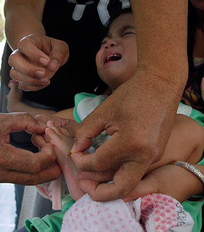 Picture Desk Live: A child with eye ailment cries while stung with a bee