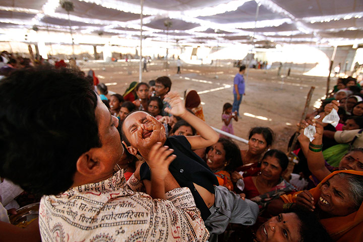 24 Hours: Hyderabad, India: A child is administered fish treatment