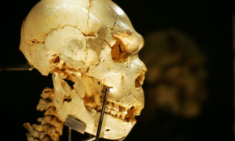 A skull from one of the bodies found in a pit in Spain. Photograph: Paul Hanna/Reuters