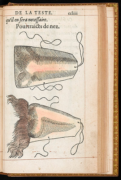 Wellcome Collection: Hand coloured illustration of a prosthetic nose