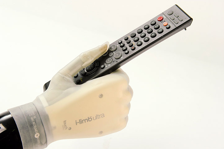 Wellcome Collection: i-limb ultra prosthetic hand 