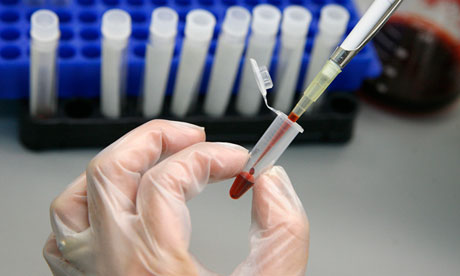 western blot hiv confirmatory test cpt code