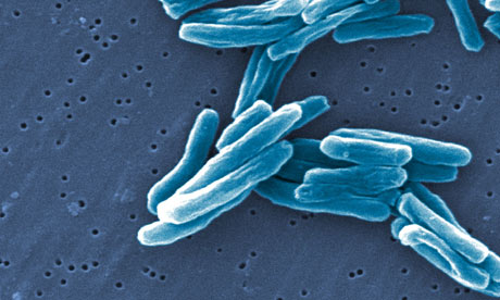 tuberculosis