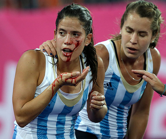 blunders gallery: Mariela Scarone