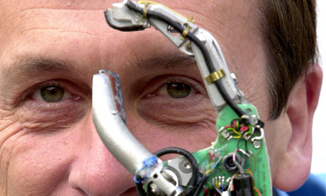 PROFESSOR KEVIN WARWICK AND HIS CYBERNETIC ARM AT READING UNIVERSITY, BRITAIN - 2002