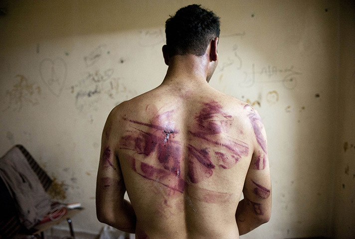 24 hours in pictures: A Syrian man shows marks of torture on his back