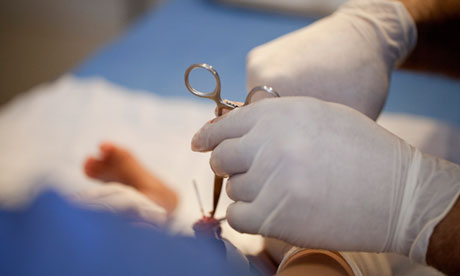 skin attached to head after circumcision