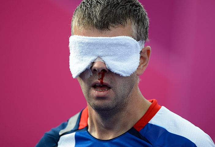 blind football: GB captain David Clarke has blood pouring from his nose