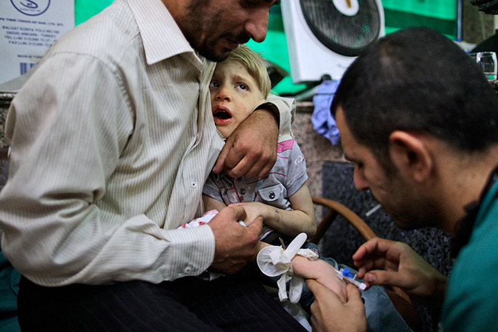 24 hours: Aleppo, Syria: A Syrian child reacts while being treated by a doctor 