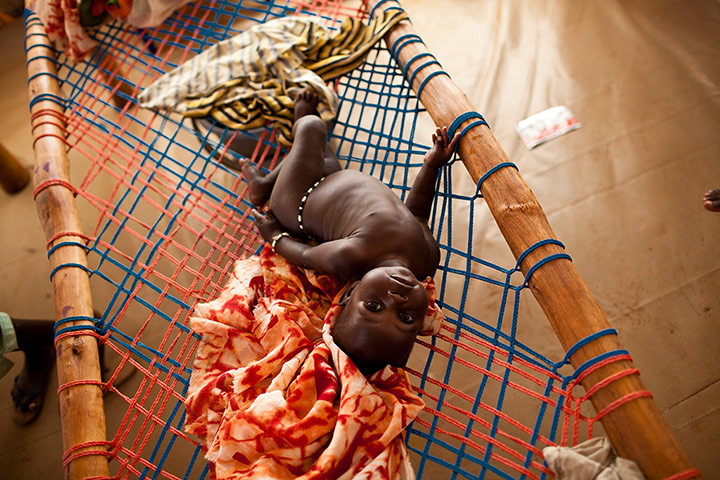 24 Hours: Yida, South Sudan: A young child stretches back on a hospital bed