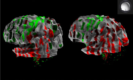 3D rendering from the Allen Human Brain Atlas