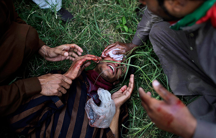 Twenty Photographs: A wounded Pakistani protester is helped during clashes with riot police