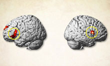 The regions of the brain to which TMS was administered