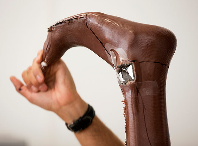 ottobock workshop: A new pair of carbon-fibre laminated Knee-Ankle-Foot-Orthosis