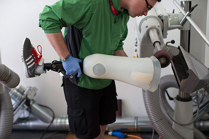 ottobock workshop: A technician grinds the top of a woman's orthotic leg