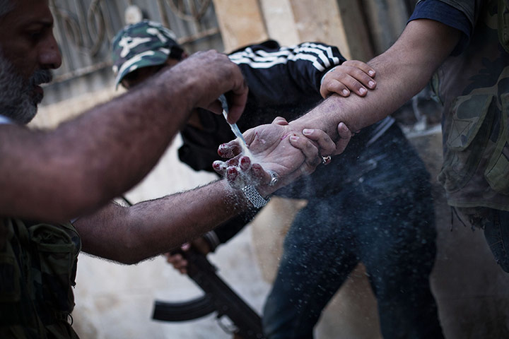 24 hours: A Free Syrian Army soldier helps a comrade treat his hand