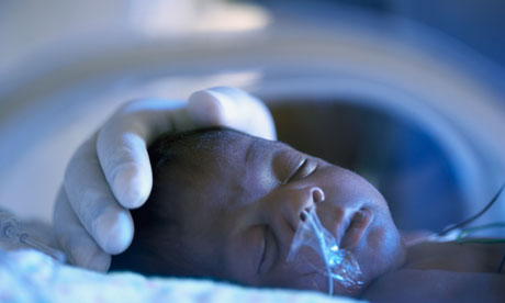 Premature Babies Survival Rate Statistics