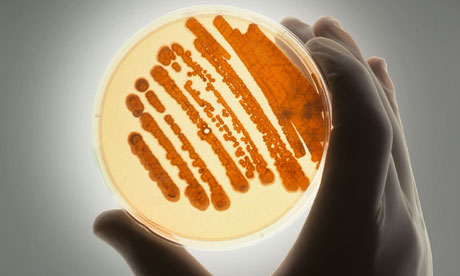 Petrie dish with bacteria in growth medium