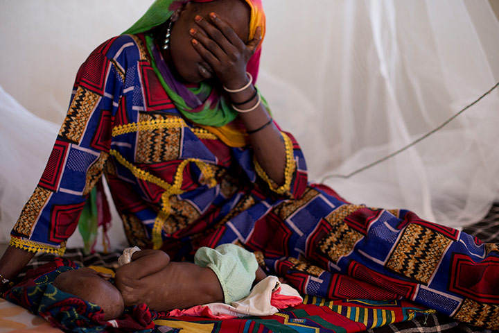 Chad Stunted Nation: malnourished children at a nutritional health clinic