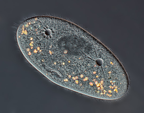 Nikon Small World: Paramecium sp. showing the nucleus, mouth and water expulsion vacuolesDiff
