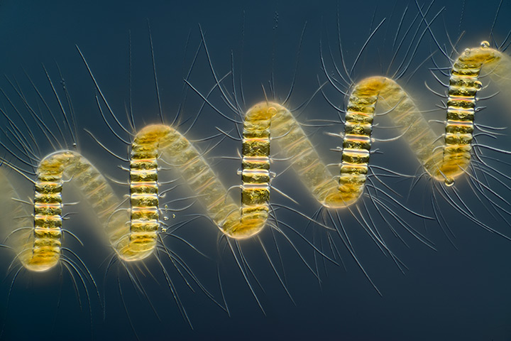 Nikon Small World: Chaetoceros debilis (marine diatom), a colonial plankton organismDifferent
