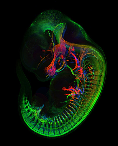 Nikon Small World: Peripheral nerves in E11.5 mouse embryo Confocal 5X                        