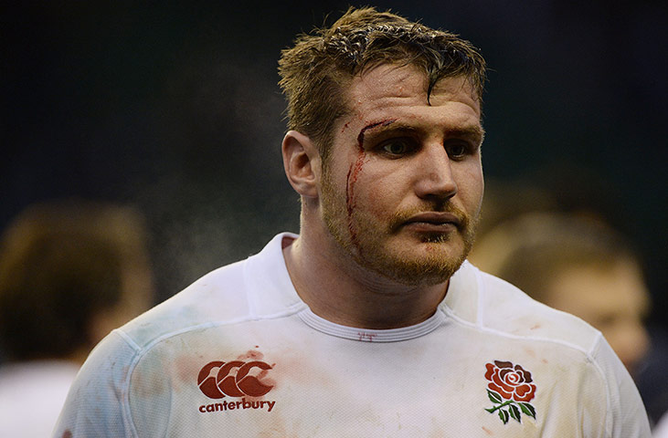 England v Argentina: Ben Morgan bleeds