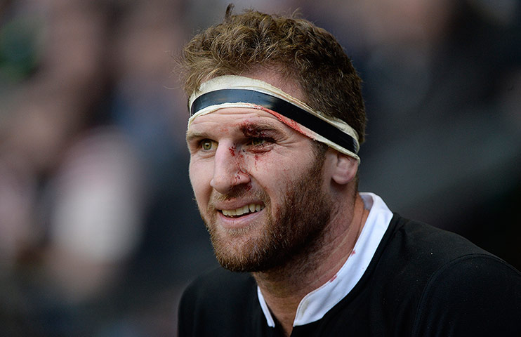 England v New Zealand: A bloodied Kieran Read