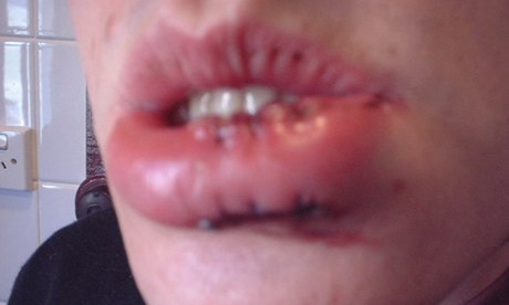 world's first selfie