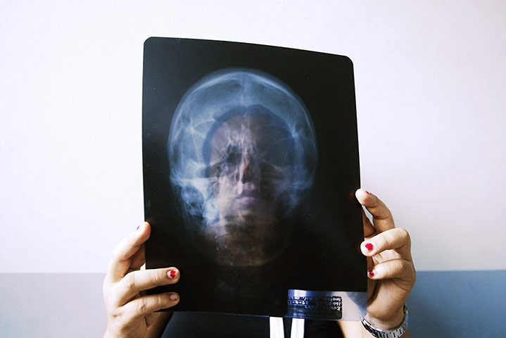 20 Photos: A woman holds an X-ray of her skull at the Rosales hospital in San Salvador