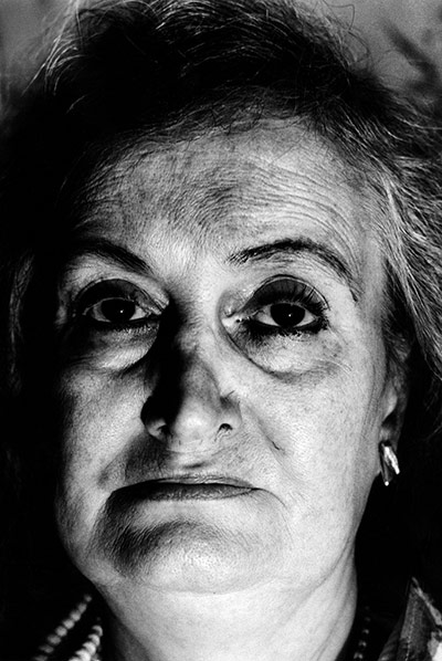 Veins: Anders Petersen 