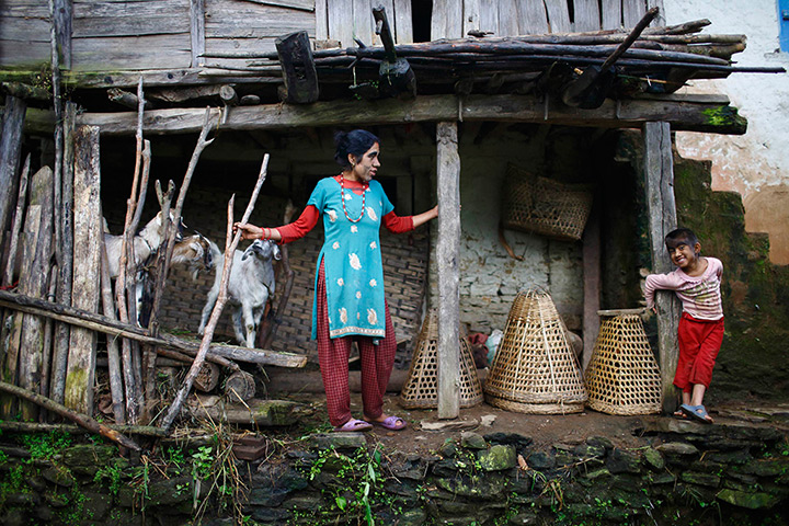 Werewolf syndrome: Devi Budhathoki and her daughter