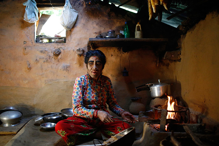 Werewolf syndrome: Devi Budhathoki cooks food on a fire in her kitchen