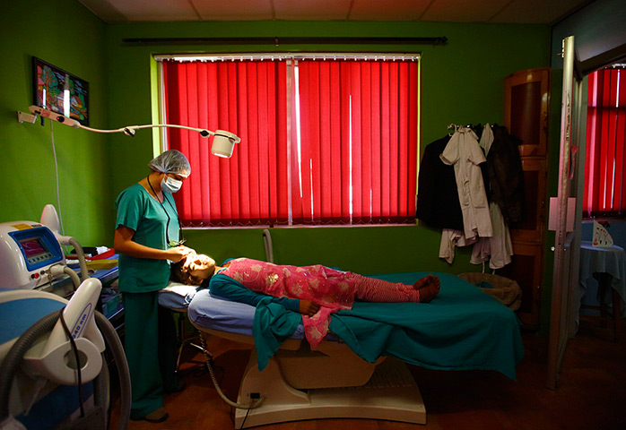 Werewolf syndrome: Manjura rests on a hospital bed as a nurse prepares her for laser hair remo