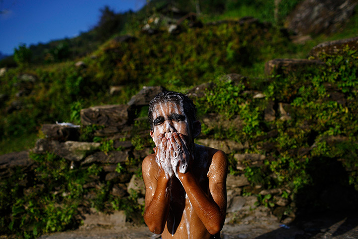 Werewolf syndrome: Niraj Budhathoki, 12, washes himself at a stone spout 