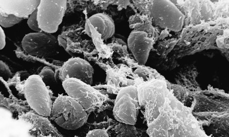 Peste bubônica bactérias